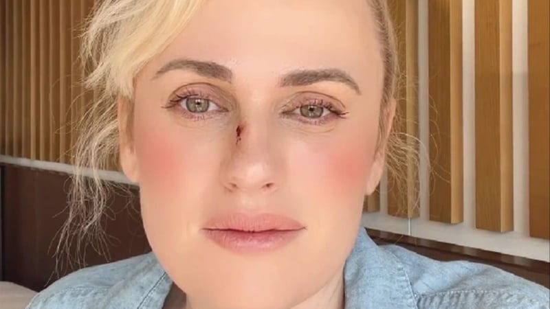 Rebel Wilson health update Bride Hard set accident