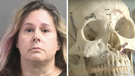 Florida Woman Arrested for Selling Human Bones