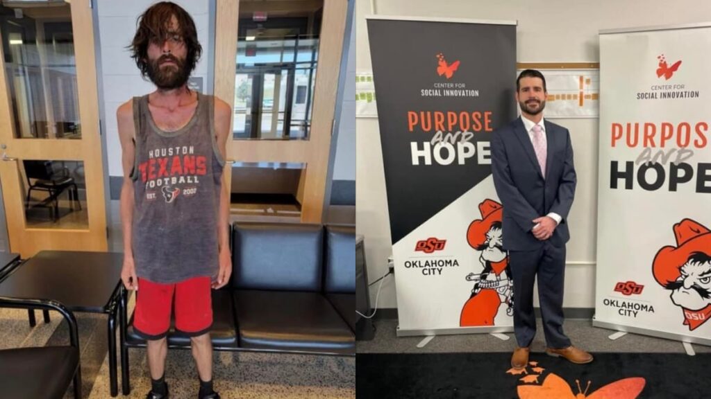 A picture of drug addict before and after.