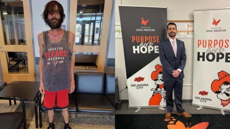 A picture of drug addict before and after.