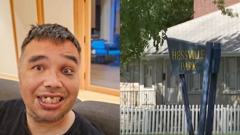 Indiana man with Autism attacked